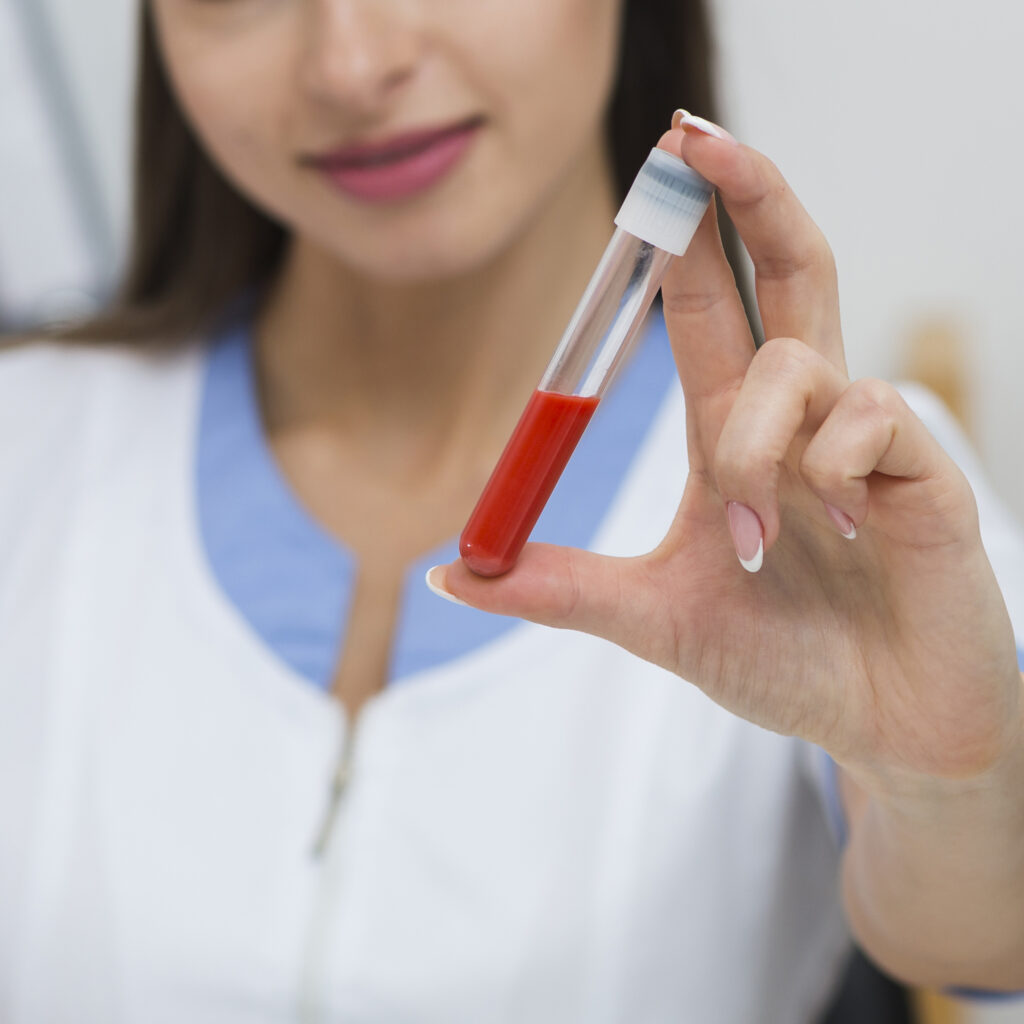 woman-hand-holding-blood-sample